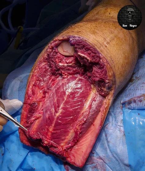 live gore.co.|GoreSee .